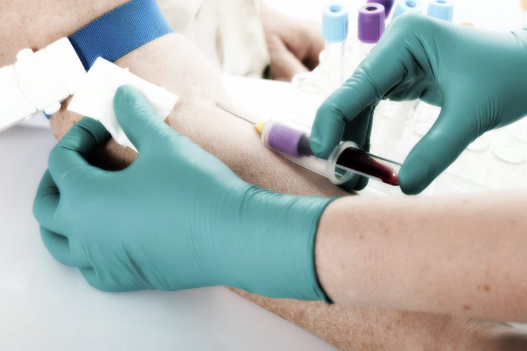 Sanità Lazio, ULS Unione Lavoratori Sanità: “La Regione Lazio dovrebbe chiedere scusa agli Infermieri”